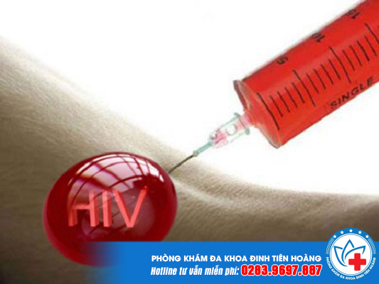 cách xử lý khi giẫm vào kim tiêm nhiễm HIV là tuyệt đối không được nặn máu ra.
