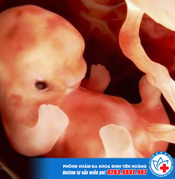 nguyên nhân và dấu hiệu nhận biết thai chết lưu