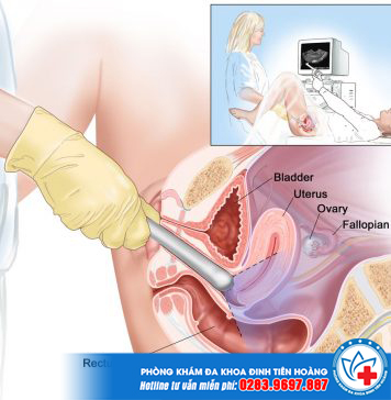 Siêu âm đầu dò có chính xác không? Nguy hiểm gì cho thai nhi?