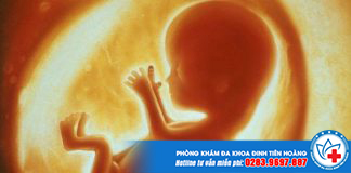 Thai chết lưu là gì?