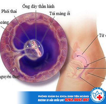 Túi thai có Yolksac là gì - Thật sự nguy hiểm không?