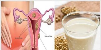Bác sĩ giải đáp u xơ tử cung có nên uống sữa đậu nành không?