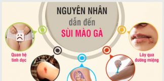 Bệnh sùi mào gà lây qua đường nào và cách phòng tránh