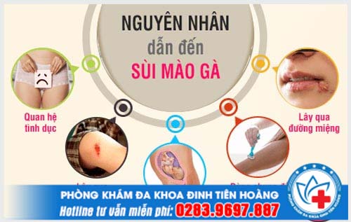 Bệnh sùi mào gà lây qua đường nào và cách phòng tránh