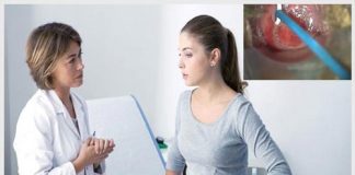 Đốt điện cổ tử cung kiêng quan hệ bao lâu là tốt nhất?