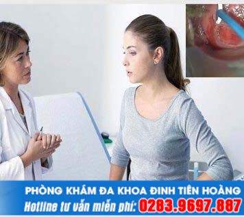 Đốt điện cổ tử cung kiêng quan hệ bao lâu là tốt nhất?