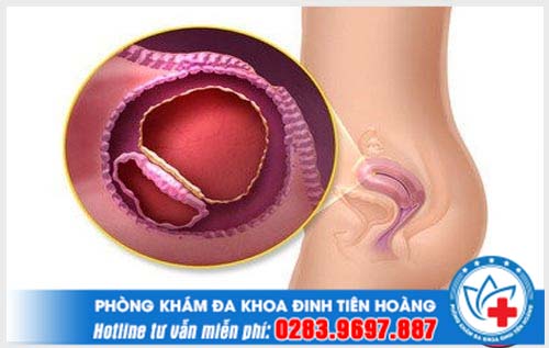 Que thử thai hai vạch rất mờ liệu có phải mang thai?