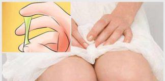 Huyết trắng màu xanh không mùi có nguy hiểm không?