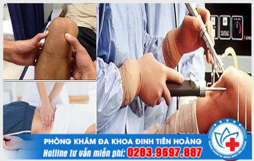 Giới thiệu phòng khám cơ xương khớp Vũng Tàu có khám ngoài giờ