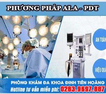 Phương pháp ALA – PDT chữa sùi mào gà có tốt không và hết bao nhiêu tiền