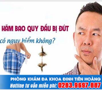 Đứt dây hãm bao quy đầu có sao không?