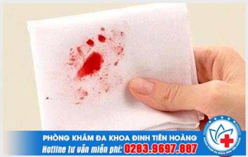 Đi vệ sinh ra máu có nguy hiểm không? Cảnh báo từ chuyên gia