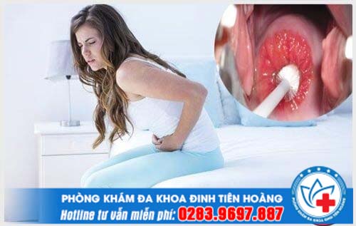 Đốt điện cổ tử cung bao lâu thì khỏi? Lưu ý giúp nhanh khỏi bệnh