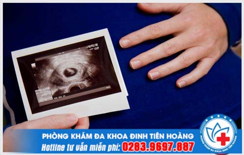 Bật mí hình ảnh phôi thai tuần thứ 8 trong cơ thể mẹ