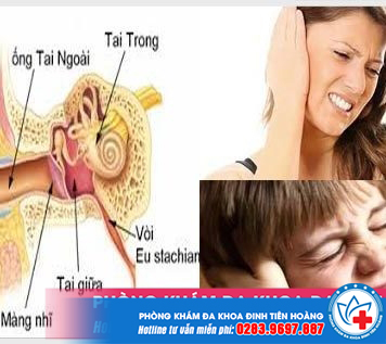 viem-tai-giua-o-tre-em-va-nguoi-lon