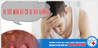 bi-sui-mao-ga-co-bi-nhiem-hiv