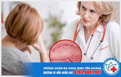 Sùi mào gà ở cổ tử cung có thể biến chứng thành ung thư, đe dọa tính mạng.