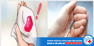 thu-que-2-vach-nhung-ra-mau