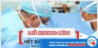 chi-phi-mo-xuong-don-2