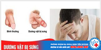 sung-duong-vat