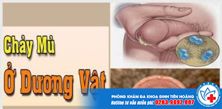 benh-chay-mu-dau-duong-vat