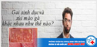 gai-sinh-duc-co-giong-sui-mao-ga-2