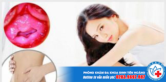 mang-trinh-khong-rach-nhung-van-co-thai