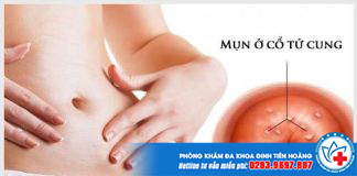 mun-o-co-tu-cung
