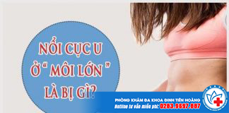 noi-cuc-u-o-moi-lon
