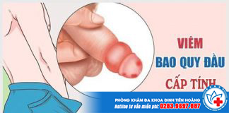 viem-bao-quy-dau-cap-tinh