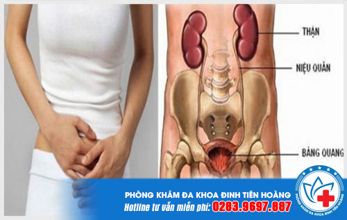 viem-duong-tiet-nieu-co-quan-he-duoc-khong