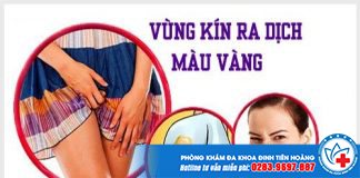 vung-kin-ra-dich-mau-vang-2