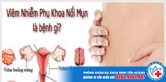 viem-nhiem-phu-khoa-gay-noi-mun