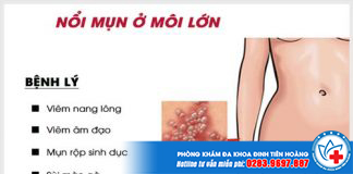 moc-mun-o-moi-lon-1-min
