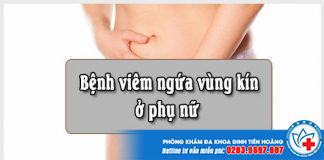 viem-ngua-vung-kin-phu-nu-1-min