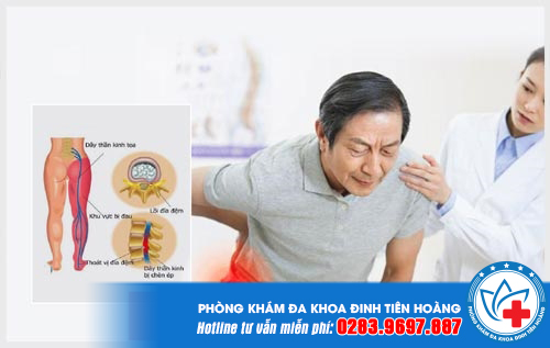 tu-van-dau-than-kinh-toa-1-min