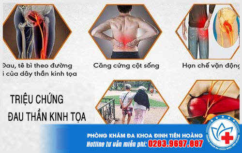 tu-van-dau-than-kinh-toa-min