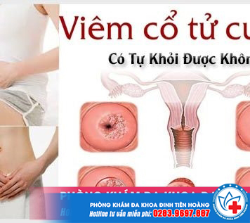 viem-co-tu-cung-co-tu-khoi-min