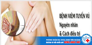 viem-tuyen-vu-la-gi-2-min