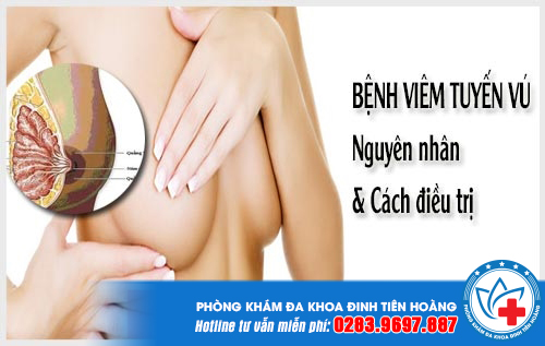 viem-tuyen-vu-la-gi-2-min