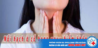 Nổi hạch ở cổ họng có nguy hiểm không