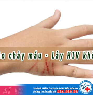 Bị cào chảy máu tay có lây bệnh HIV không