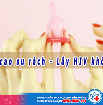 quan hệ bị rách bao cao su có bị hiv không